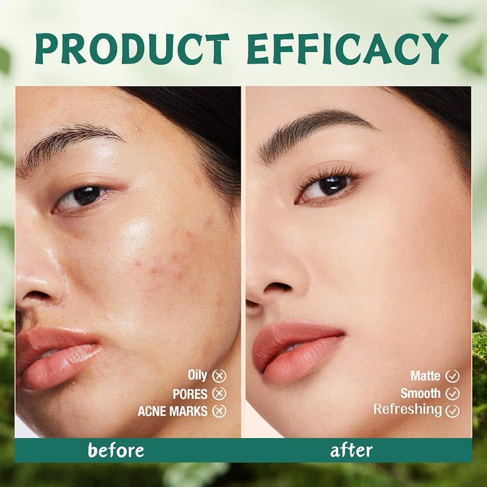 KORMESIC Exfoliate Oil Control Minimize Pores Salicylic Acid Cream