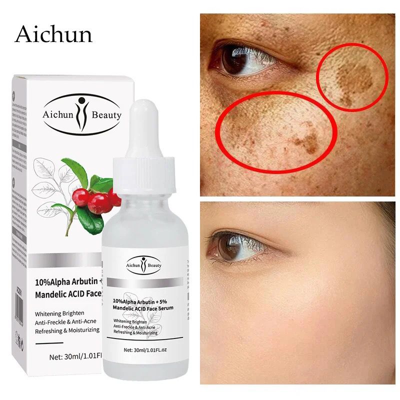 Aichun Beauty 10%Alpha Arbutin + 5% Mandelic Acid Face Serum 30ml