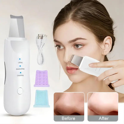 Home Face Pore Cleaning Massage Spatula Machine Exfoliating & Suctioning Blackheads & Acne