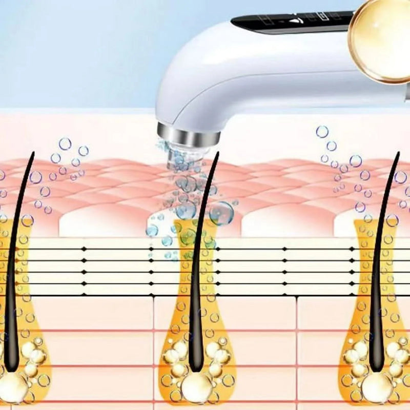 HydraFacial Pore Vacuum Blackhead Remover 2in1 Deep Cleansing and Hydrating Pimple Extractor Tool With 6 Suction Heads 3 Gears Adjustable