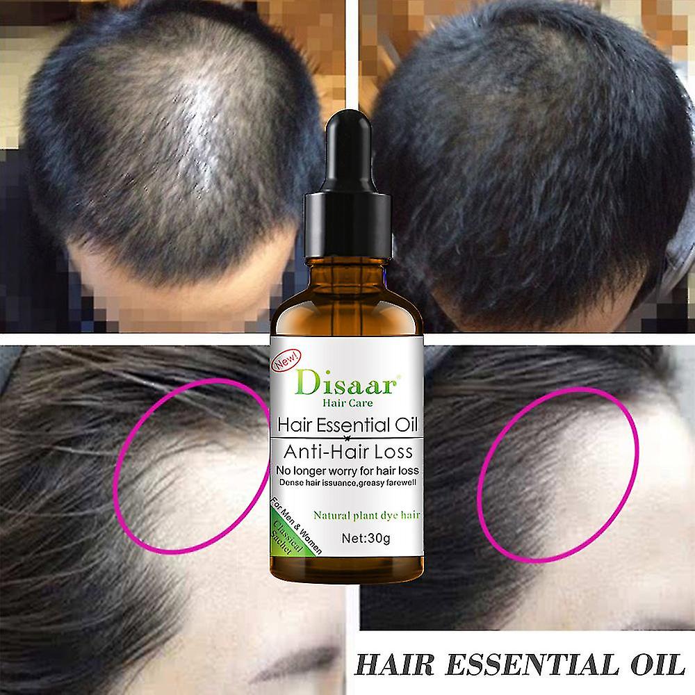 Disaar Anti Hair Loss Hair Serum