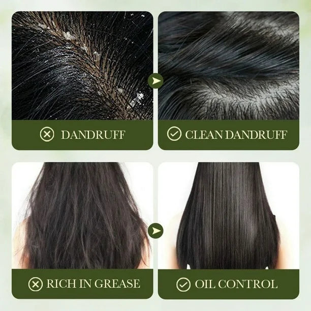 Sadoer Olives Oil 98% Olive + Amino Acid Squalane Nourishing Dandruff Removal Anti-Itch Shampoo 500ml