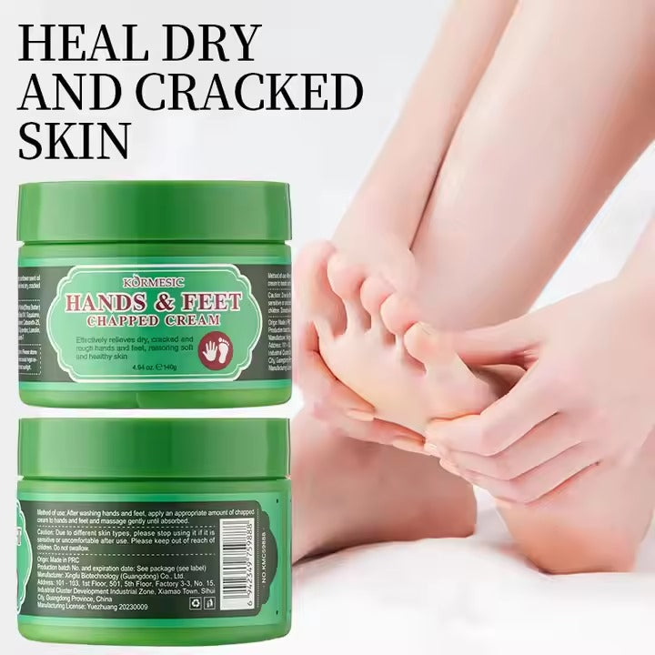 KORMESIC Anti-chapping Moisturizing Improve Roughness Smoothing Chapped Hands and Feet Cream 140g
