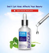 BIOAQUA Face Acne Treatment Scar Removal Spots Pimples Moisturizing Essential Oil 30ml