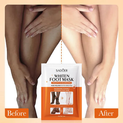 SADOER Vitamin C Skin Care Dark Skin Lightening &amp; Whitening Moisturizing Foot Mask