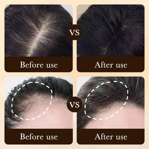 ZOZU Fast Hair Growth Essence Effective Anti Hair Loss & Hair Care Serum 20ml