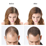 Dexe Hair Building Fibers 22g | For Men & Women