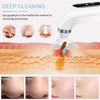 HydraFacial Pore Vacuum Blackhead Remover 2in1 Deep Cleansing and Hydrating Pimple Extractor Tool With 6 Suction Heads 3 Gears Adjustable