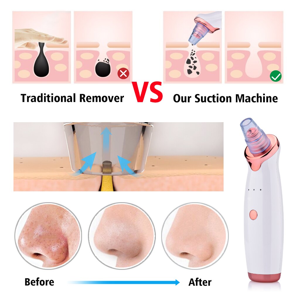 Rechargeable Blackheads Removal Machine Blackhead Remover Vacuum Electric Nose Beauty Face Deep Cleansing