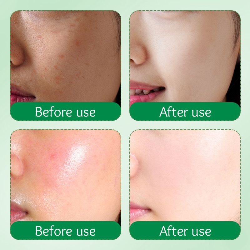 SADOER Milk Avocado Organic Skin Care Anti-Aging Beauty Cream Korean Goat Milk & Avocado Moisturizing with Niacinamide & Vitamin E Face Cream