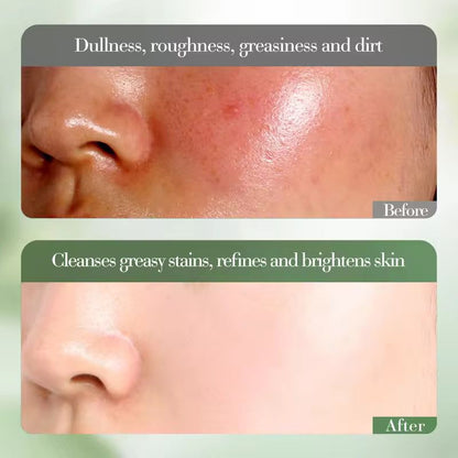 FAYANKOU Lemon Extract Vitamin C Whitening Oil Control Moisturizing Smooth Brightening Face Wash