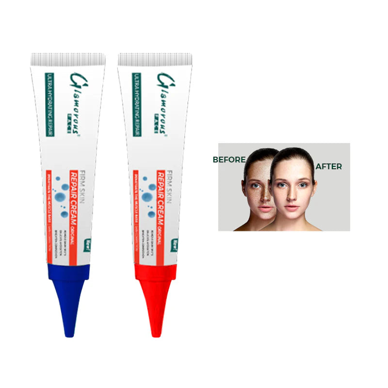 Glamorous Face Anti Dark Spot Removing Cream