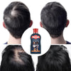 Caffeine C1 Hair Shampoo for Hair Loss Prevention Anti Hair Loss