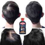 Caffeine C1 Hair Shampoo for Hair Loss Prevention Anti Hair Loss