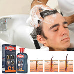 Caffeine C1 Hair Shampoo for Hair Loss Prevention Anti Hair Loss