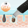 Rechargeable Ultrasonic Skin Scrubber Deep Face Cleaning Machine