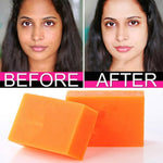 GuanJing Beauty Kojic Acid Whitening Soap For Face And Body