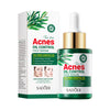 Sadoer Tea Tree Acnes Oil Control Face Serum