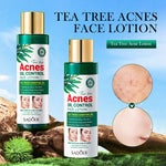 Sadoer Tea Tree Acnes Oil Control Face Lotion 120ml