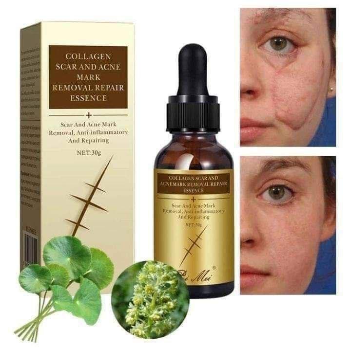 Pei Mei Collagen Scar And Acne Mark Removal Repair Essence