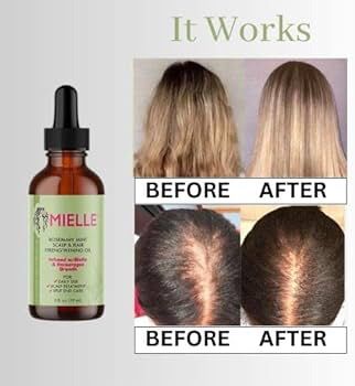 MIELLE Rosemary Mint Scalp And Hair Strengthening Oil And Hair Growth Essential Oil