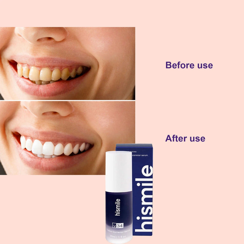 Hismile V34 Purple Teeth Whitening Colour Corrector Serum Tooth Stain Removal Teeth Whitening Booster Toothpaste 30ml