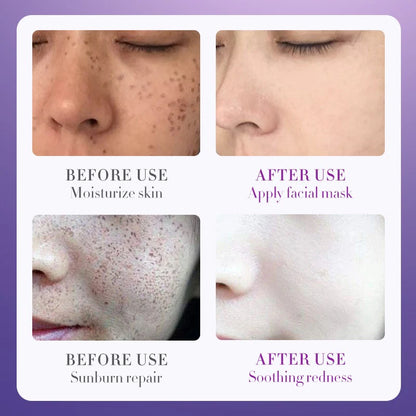 SADOER Nicotinamide Whitening Anti Freckle Moisturizing Toner 100ml