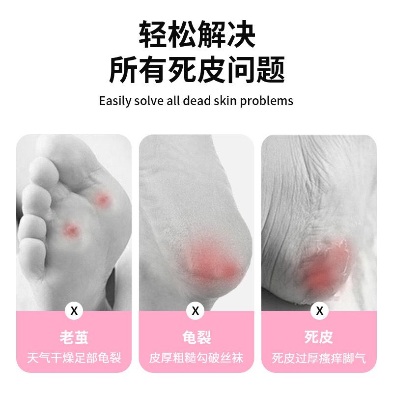 Steel Foot Filer Callus Remover Cracked Heel Repair