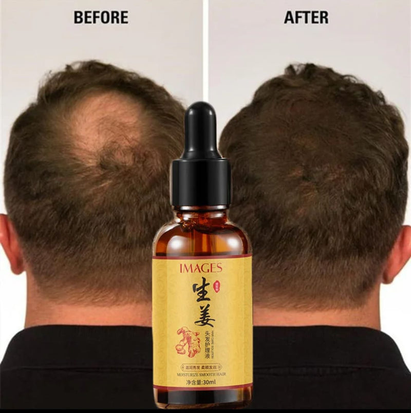 Images Hair Growth Serum