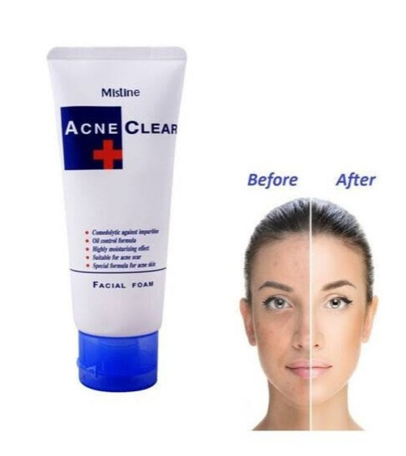 Mistine Acne Clear Facial Foam
