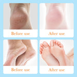 SADOER Foot Anti Chapped Gel Tender Smooth Feet Shea Butter Improve Dry Rough Skin Roll On Feet Gel 50ml