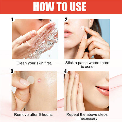 Skin Tag Remover Acne Patches Quick Effective Mole Wart Removal Pad Sticker 36pcs in 1 Card