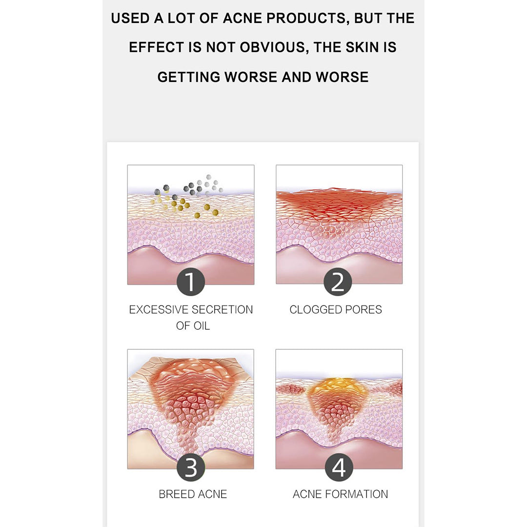 Dr RASHEL ALOE VERA ANTI ACNE PIMPLE CREAM