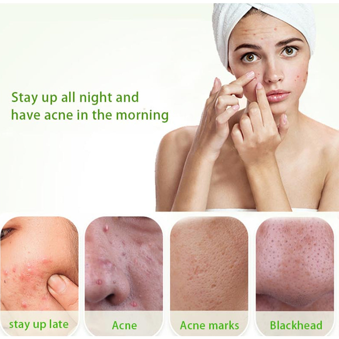 Dr RASHEL ALOE VERA ANTI ACNE PIMPLE CREAM