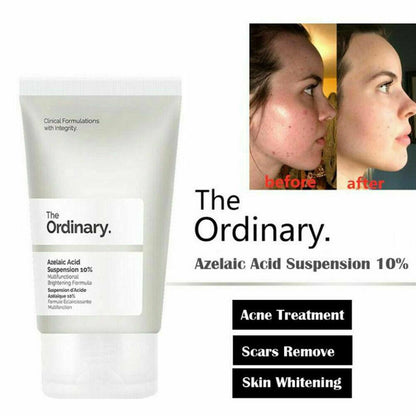 The Ordinary Azelaic Acid Suspension 10%