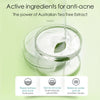 Skin Ever Tea Tree Acne Treatment Serum