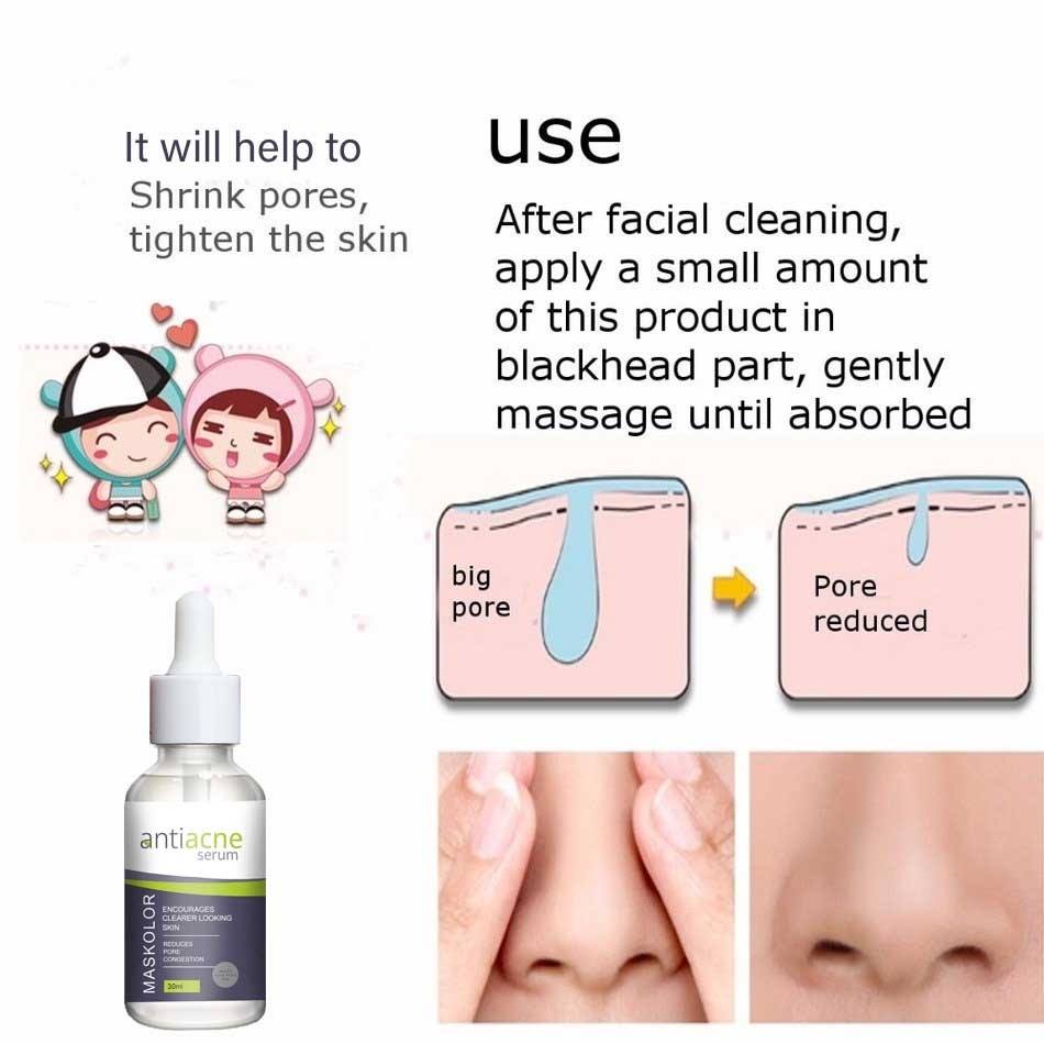 Maskolar Antiacne Serum