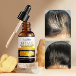 SADOER Ginger Anti-Hair Loss Oil Essence 30ml