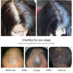 Disaar Anti Hair Loss Spray 30ml