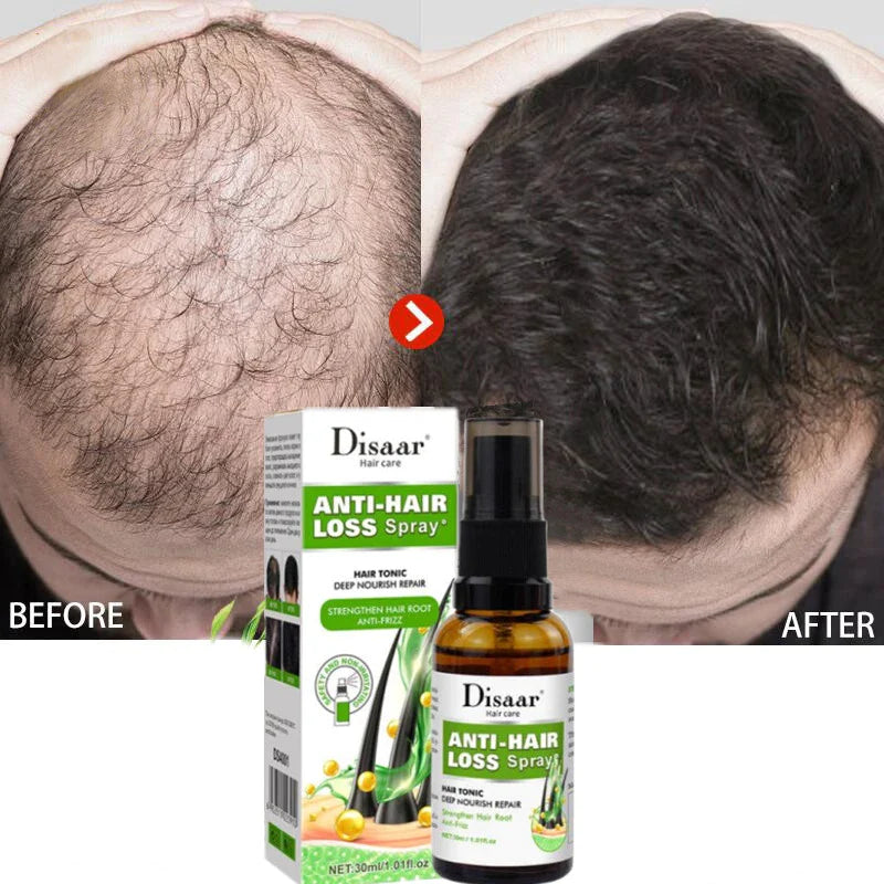 Disaar Anti Hair Loss Spray 30ml