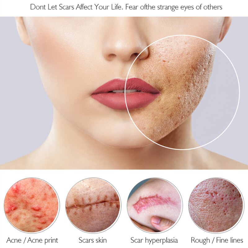 Aichun Beauty Medical Formula Remove Scars Whitening Facial Serum