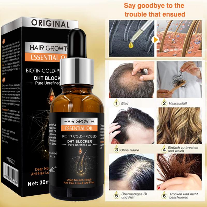 Ginger Hair Growth Hair Thickening Hair Loss Treatments Oil 30ml