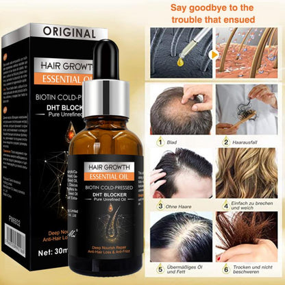 Ginger Hair Growth Hair Thickening Hair Loss Treatments Oil 30ml