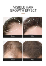 Skin Ever Hair Growth Essential Oil
