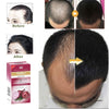 Wellice Onion Anti Hair loss Solution 3in1 Deal